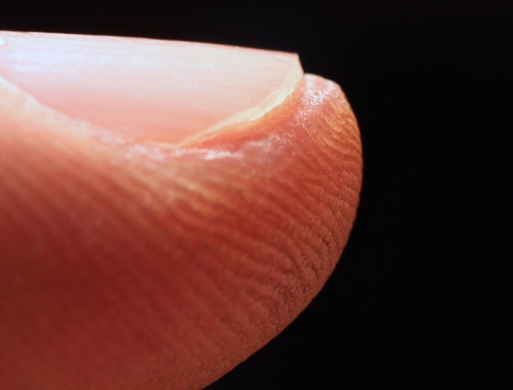 close-cut-fingernails